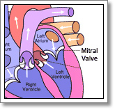 Mitral Valve Repair - Heart Surgery - Raney Zusman Medical ...